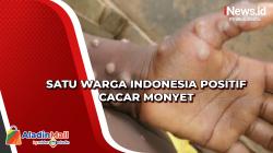 Satu Warga Indonesia Positif Cacar Monyet