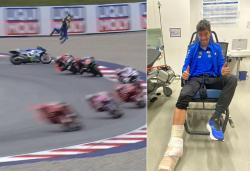 Joan Mir Kecelakaan Parah di MotoGP Austria 2022, Begini Kondisinya Sekarang