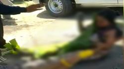 Duar, Karung Petasan Meledak, Ibu dan Anak di Indramayu Terluka Bakar 