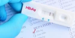  Mengenal Tes HBsAg Adalah untuk Deteksi Hepatitis B