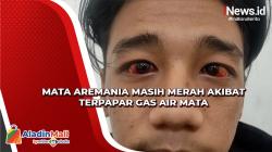 Kondisi Mata Aremania Masih Merah akibat Terpapar Gas Air Mata Pascatragedi Maut Kanjuruhan