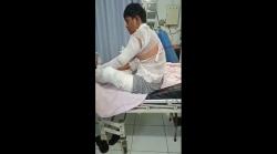 Gerobak Ditabrak Pemotor, Tubuh Penjual Mi Ayam di Jember Melepuh Tersiram Air Panas