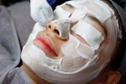 Bukan Cuma Pakai Skincare, Ini 4 Cara Menghilangkan Bekas Jerawat Menghitam di Wajah