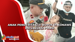 Anak Penderita Gizi Buruk di Konawe Dievakuasi Polisi