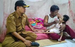 Kasus Gizi Buruk di Indramayu, Remaja 15 Tahun Kurus Kering dan Tak Bisa Bicara <