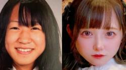 Operasi Plastik sejak Kelas 5 SD, Wanita Jepang Ini Habiskan Rp 1,1 Miliar<