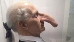  Pria Ini Miliki Hidung 19 Cm, Terpanjang di Dunia<