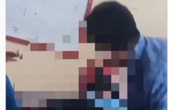 Polisi Periksa Pelaku Perundungan Pelajar SMP di Bandung, Orang Tua Buat Laporan