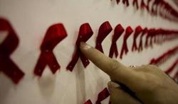 Dinkes Temukan 139 Kasus HIV/AIDS di KBB, Dominan Kategori Lelaki Suka Lelaki<