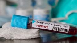 Virus Covid-19 Varian Baru Sebabkan Lonjakan Kasus di Singapura dan AS, Waspadai Gejala Ini