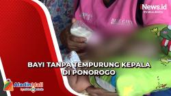 Begini Kondisi Bayi Tanpa Tempurung Kepala dan Bibir Sumbing di Ponorogo