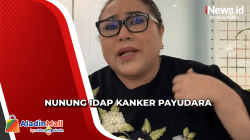 Mengejutkan! Nunung Srimulat Idap Kanker Payudara