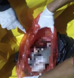 Jasad Bayi Ditemukan Membusuk di Tangerang, Terbungkus Plastik Merah