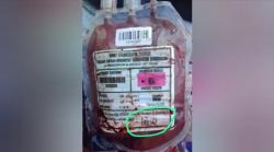 Temuan Kantong Darah HIV di TPS, Polisi Panggil PMI Bangkalan
