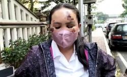 Kasus Perempuan Ditabrak Pacar di Kebayoran Baru, Polisi Cari CCTV di Lokasi