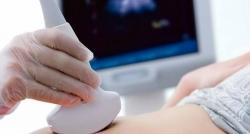 Ketahui Pentingnya Deteksi Kelainan Genetik pada Ibu Hamil sejak Kandungan 10 Minggu
