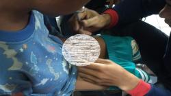 Gegara Kemaluan Terjepit Ritsleting Berjam-jam, Bocah Dievakuasi ke Damkar Cimahi