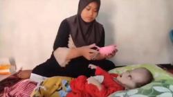 Pilu, Bayi 8 Bulan di Tasikmalaya Derita Hidrosefalus, Butuh Uluran Tangan Dermawan