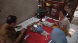 2 Bocah asal Subang Idap Lumpuh Otak, Tak Berdaya Hanya Berbaring