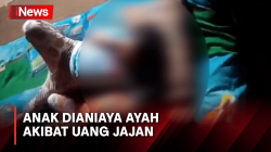Anak Perempuan di Sukabumi Dianiaya Ayahnya akibat Uang Jajan