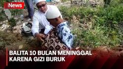 Balita 10 Bulan di Mandailing Natal Meninggal akibat Gizi Buruk