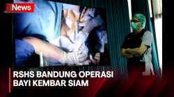 Hasan, Bayi Kembar Siam Meninggal Usai Opersasi Pemisahan di RSHS Bandung