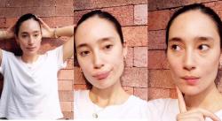 Potret Artis Tak Malu Pamer Wajah Jerawatan, Malah Dipuji Netizen 