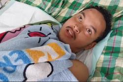Kesaksian Arbi Muharman Korban Erupsi Gunung Marapi: Sempat Kena Hujan Batu