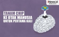 Infografis Perusahaan Elon Musk Neuralink Tanam Chip ke Otak Manusia, Pertama Kali di Dunia!