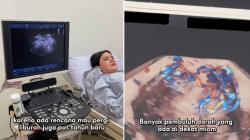 Alice Norin Ungkap Kena Kanker Sarkoma: Nyeri Banget