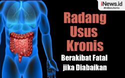 Infografis Radang Usus Kronis Bisa Berakibat Fatal jika Diabaikan