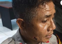 Amankan Aksi Massa, Kapolres Mamberamo Tengah AKBP Rahman Kena Panah<