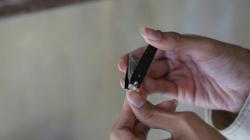 Kapan Mulai Tidak Boleh Potong Kuku bagi yang Berkurban? Ini Penjelasan Ulama