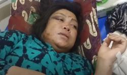 Cerita Pilu Watmi Korban Selamat Longsor Pekalongan: Anak Saya Sudah Tidak Ada<
