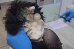 Pria Ini Pakai Rambut Palsu Berisi 19 Kapsul Kokain