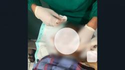 Mantan Kapolsek Mulia Tewas Ditembak OTK, Peluru Tembus Pipi hingga Leher Belakang<
