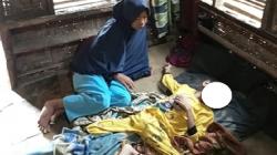 Kisah Pilu Bocah di Lebak Stunting Berat karena Keterbatasan Ekonomi, Kondisinya Mengenaskan<