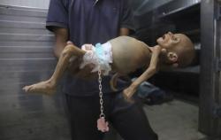 Bunuh 65.000 Lebih Warga Gaza, Netanyahu Tak Merasa Lakukan Genosida