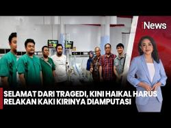Sedih, Dua Santri yang Selamat dari Reruntuhan Ponpes Al Khoziny Harus Diamputasi