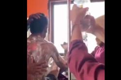 Tolak Cari Rumput, Pemuda di Sumbawa NTB Dibakar Ibu Kandung<