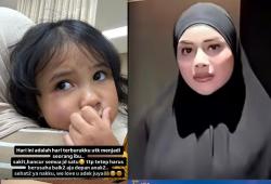 Anak Kedua Aurel Hermansyah Jatuh dari Tangga, Azura Dirawat di Rumah Sakit