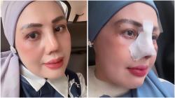 Elly Sugigi Habiskan Rp65 Juta untuk Oplas Hidung dan Mata, Akui Lelah Dihina!