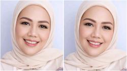 Heboh! Elly Sugigi Hanya Incar Pria Ganteng untuk Dinikahi usai Oplas Hidung