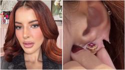 Ngeri Banget! Kuping Tasya Farasya Sobek Terbelah Dua