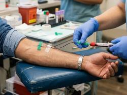 Apa Arti Hasil Tes HIV Non-Reaktif yang Viral gegara Ruben Onsu?