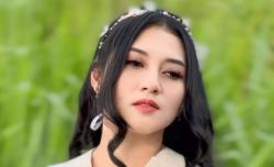 Artis Sali Irsalina Lapor Polisi Diduga Dianiaya Pacar
