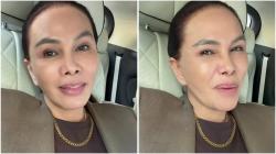 Dilaporkan Doktif ke Polisi, Fitri Salhuteru: Nggak Takut!