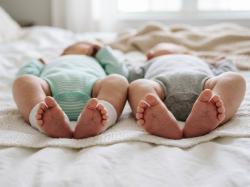 RSCM Sukses Pisahkan Bayi Kembar Siam Dempet Perut Lewat Operasi 36 Jam
