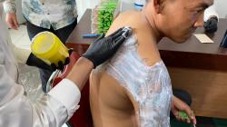 Hapus Tato Gratis di Bandung: Bantu Warga Memulai Hidup Baru Tanpa Stigma