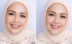Penampilan Elly Sugigi Bikin Pangling usai Operasi Plastik, Incar Pria Ganteng jadi Suami